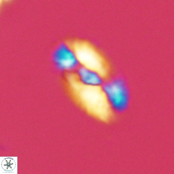 Helicosphaera neointermedia VR 05328