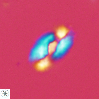 Helicosphaera neointermedia VR 05329
