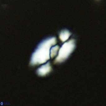 Helicosphaera neointermedia VR 05330