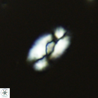 Helicosphaera neointermedia VR 05330