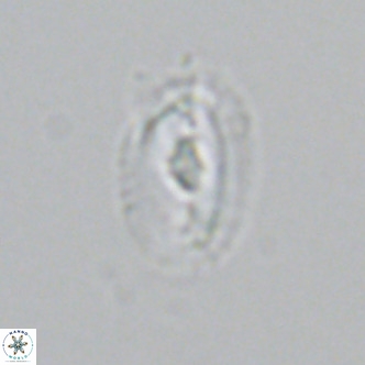Helicosphaera neointermedia VR 05332