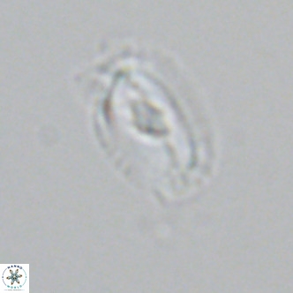 Helicosphaera neointermedia VR 05333
