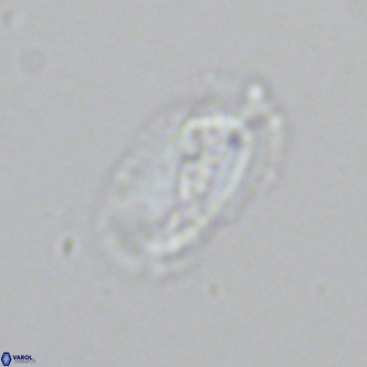 Helicosphaera neointermedia VR 05334