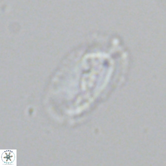 Helicosphaera neointermedia VR 05334