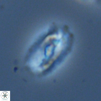 Helicosphaera neointermedia VR 05335