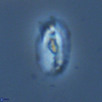 Helicosphaera neointermedia VR 05336