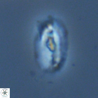 Helicosphaera neointermedia VR 05336