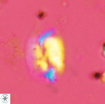 Helicosphaera antistrofaobliqua 2326