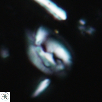 Helicosphaera obliqua 1878