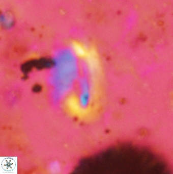Helicosphaera obliqua 2373