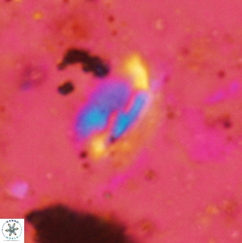 Helicosphaera obliqua 2374
