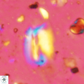 Helicosphaera obliqua 2398