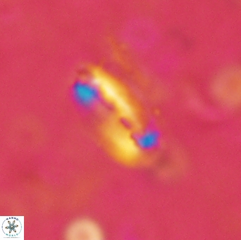 Helicosphaera acuta 2971