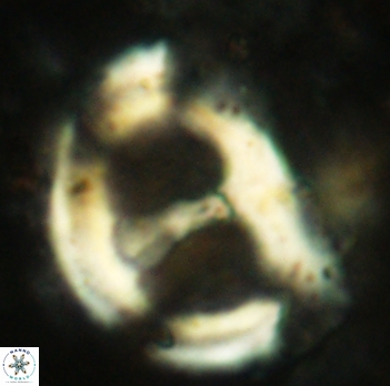 Helicosphaera ampla 2344