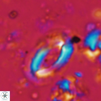 Helicosphaera ampliaperta 348
