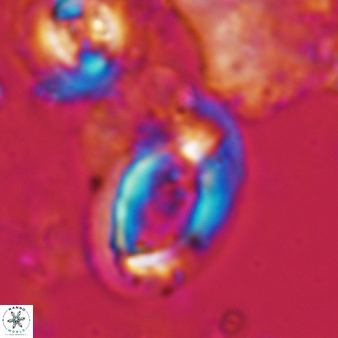Helicosphaera ampliaperta 350