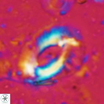 Helicosphaera ampliaperta 352