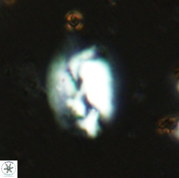 Helicosphaera antistrofaobliqua 2325