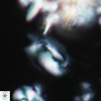 Helicosphaera antistrofaobliqua 456