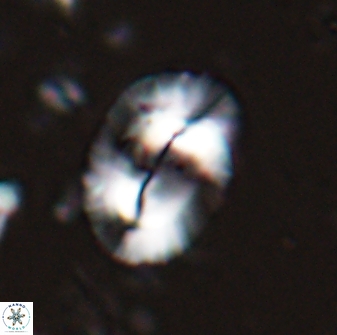 Helicosphaera burkei obesus 27628
