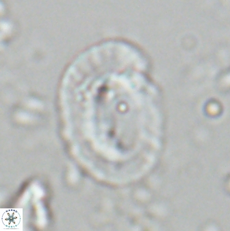 Helicosphaera burkei obesus 27634
