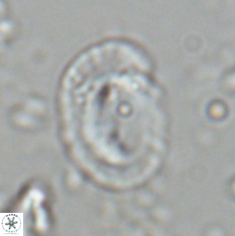 Helicosphaera burkei obesus 27635
