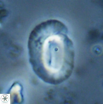 Helicosphaera burkei obesus 27636