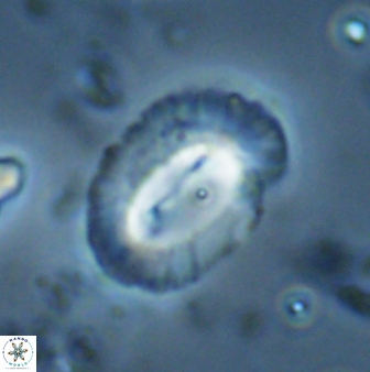Helicosphaera burkei obesus 27637