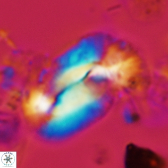 Helicosphaera burkei 438