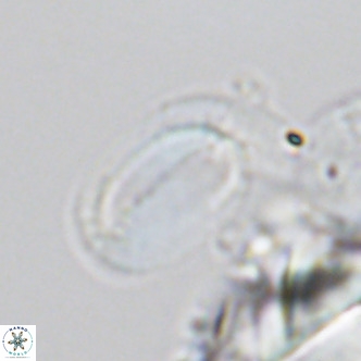 Helicosphaera burkei VR 04555