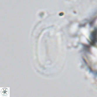 Helicosphaera burkei VR 04556