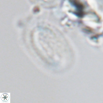 Helicosphaera burkei VR 04557