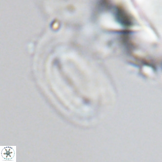 Helicosphaera burkei VR 04558
