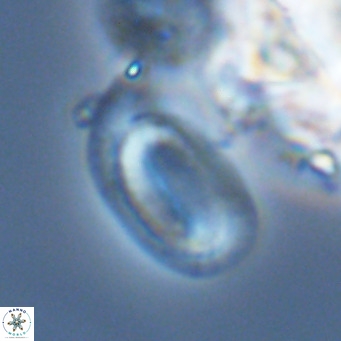 Helicosphaera burkei VR 04560