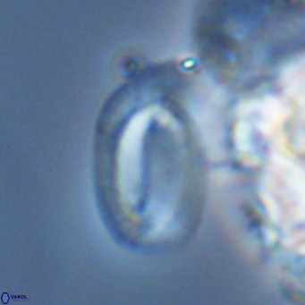 Helicosphaera burkei VR 04561