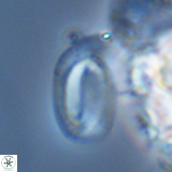 Helicosphaera burkei VR 04561
