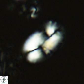 Helicosphaera burkei VR 05152