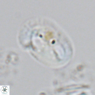 Helicosphaera burkei VR 05158