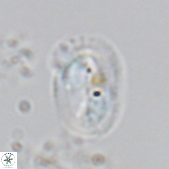 Helicosphaera burkei VR 05159
