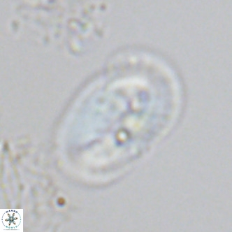 Helicosphaera burkei VR 05162