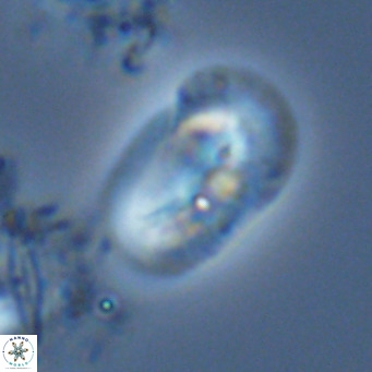 Helicosphaera burkei VR 05163