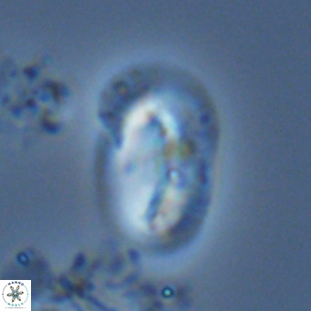 Helicosphaera burkei VR 05164