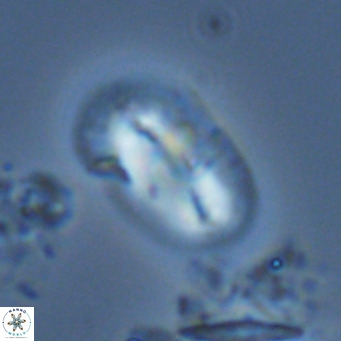Helicosphaera burkei VR 05165