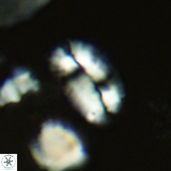 Helicosphaera burkei VR 05291