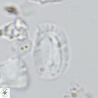 Helicosphaera burkei VR 05295