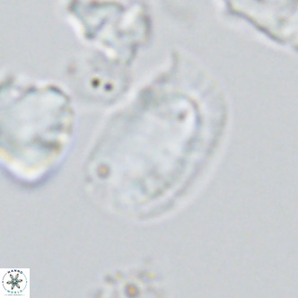 Helicosphaera burkei VR 05296