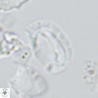 Helicosphaera burkei VR 05298