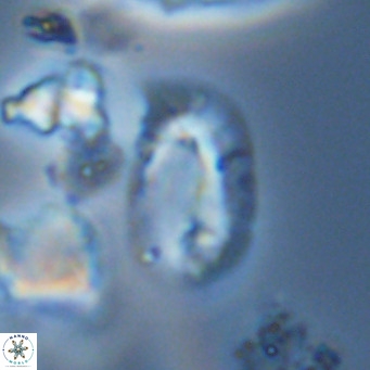 Helicosphaera burkei VR 05300