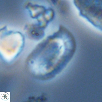 Helicosphaera burkei VR 05302