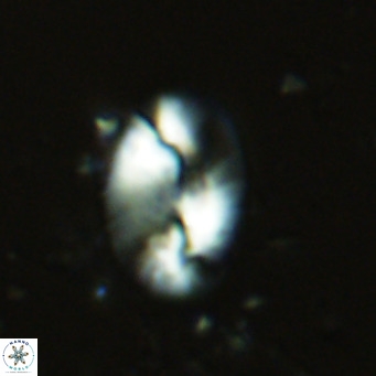 Helicosphaera burkei VR 07815